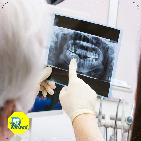 فواید استفاده از سنسور rvg در دندانپزشکی چیست؟